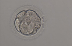 Laser assisted hatching